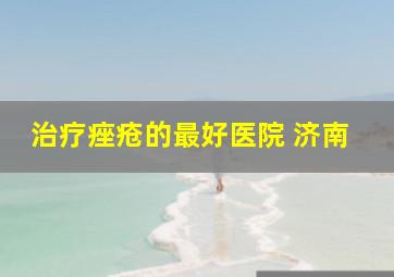 治疗痤疮的最好医院 济南